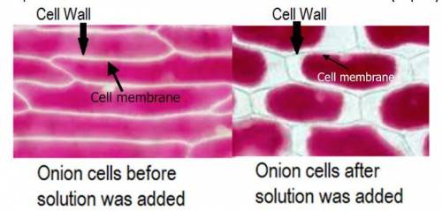 A student observes the following onion cells in the microscope. What type of solution was added to