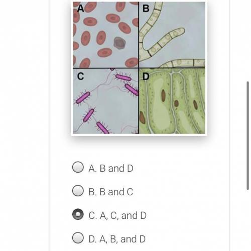 Which of the samples shown below are eukaryotic?

(I’m obv. not sure if the selected is right.. I