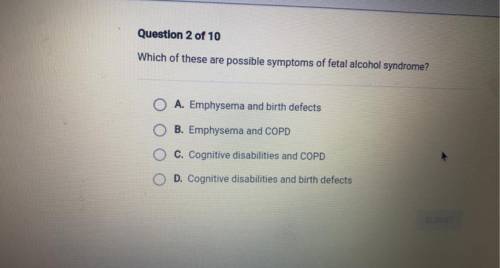 Which of these are possible symptoms of a fetal alcohol syndrome￼