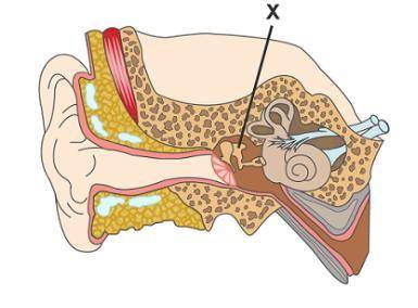 This is a diagram of the ear.

Which structure is marked with an X?
hammer
anvil
stirrup
cochlea