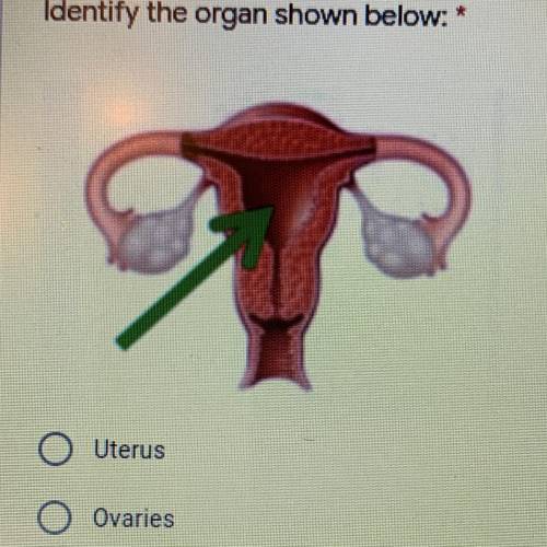 Identify the organ shown below:

A. Uterus
B. Ovaries
C. Vagina
D. Fallopian tubes