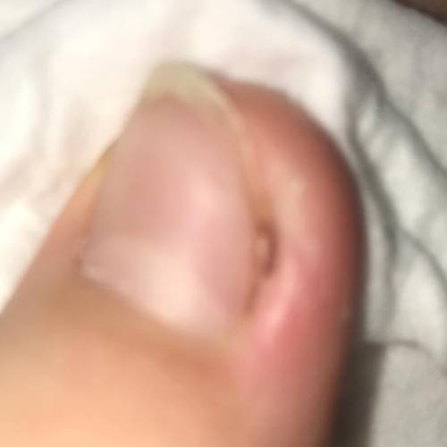HELP! There’s a brown spot in the crease of my toe, please tell me what it is!

It is kinda tickly