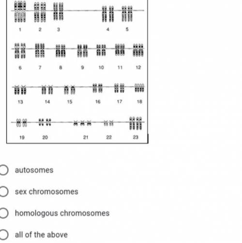 A karyotype like figure 2 shows which of the following? Please answer fast!!