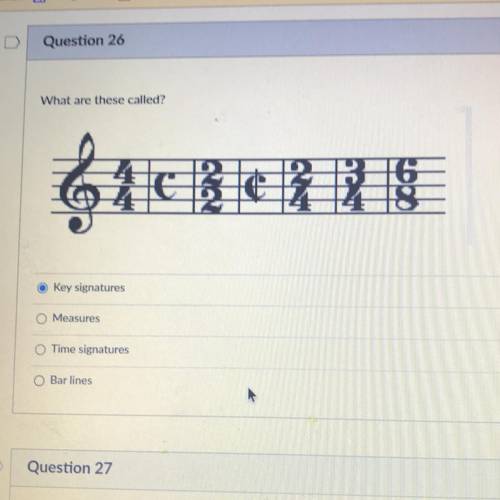 Orchestra not AP but it wasn’t an option