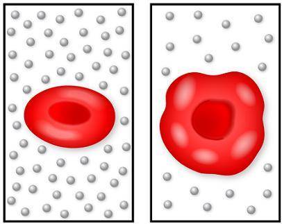 The image on the left shows a normal red blood cell, and the image on the right shows a cell that h