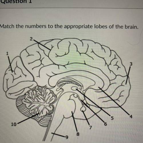 Match the numbers to the appropriate lobes of the brain.