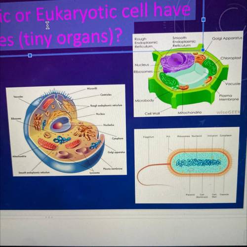 Does a Prokaryotic or Eukaryotic cell have organelles (tiny organs)?

Prokaryotic:
Eukaryotic: