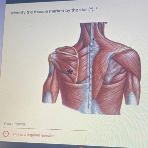 Identify the muscle marked by the star (*): *
Your answer