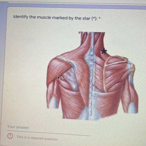 Identify the muscle marked by the star (*): *
24 points