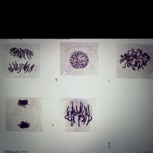 Which of the cells in the images below are most likely NOT in mitosis?