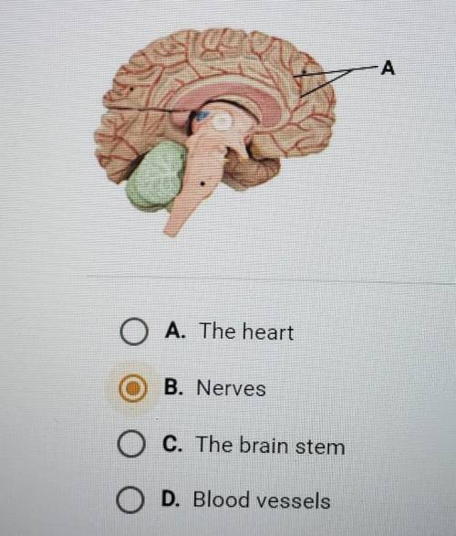 What does the structure labeled A represent in the model of the human brain below?
