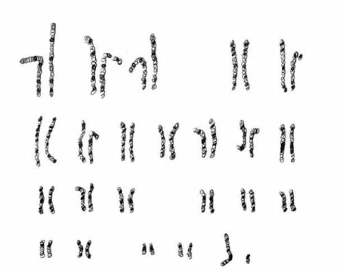 1) Based on the picture, is this a karyotype of a diploid or haploid cell? Explain how you know.