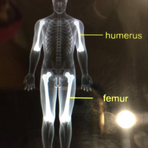 In what way are the humerus and the femur similar?

humerus
femur
O A. They both attach their resp