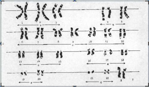 Karyotype A

1.) Karyotype A is the first set of chromosomes we will look at. Notice that the chro