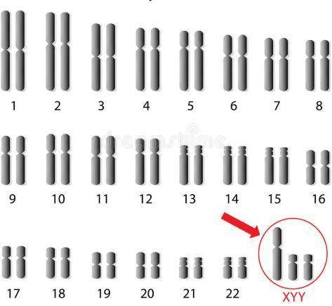 The karyotype below depicts a mutation on chromosome #23. What type of mutation is this?

a
deleti