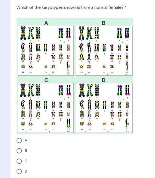 Which of the karyotypes shown is from a normal female?
A
B
C 
D