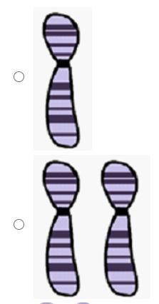 Which illustration depicts homologous chromosomes?
Will give brainliest.