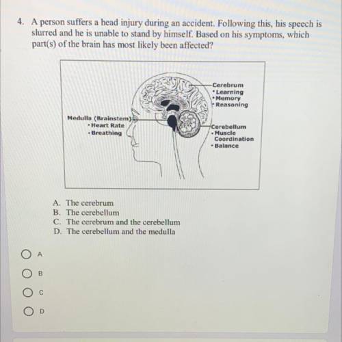 MQ : Which parts of the brain had most likely been affected?