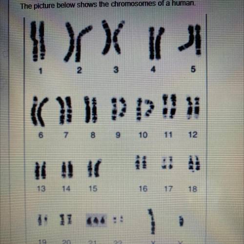 What caused the chromosomal alteration in number 21?