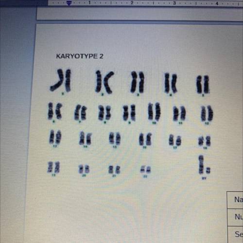 KARYOTYPE 2

•Name of karyotype ?
•Number of chromosomes?
•Sex of individual?
•Normal? yes or no?