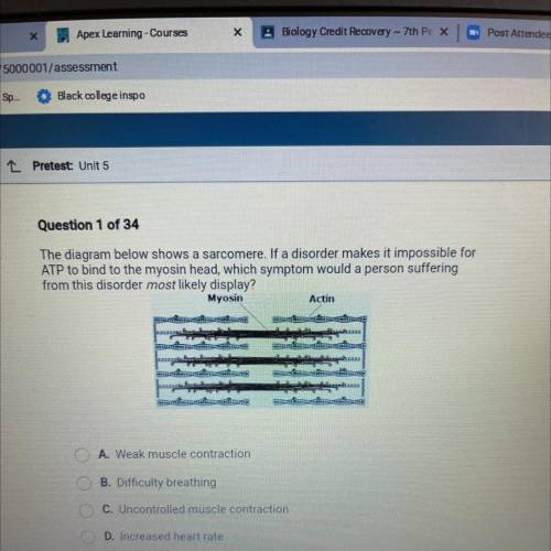 Help ASAP WILL GIVE BRAINLIEST Question 1 of 34

The diagram below shows a sarcomere. If a disorde
