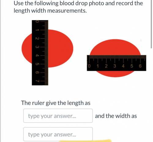 Help help help! Use the following blood drop photo an record the length width measurements