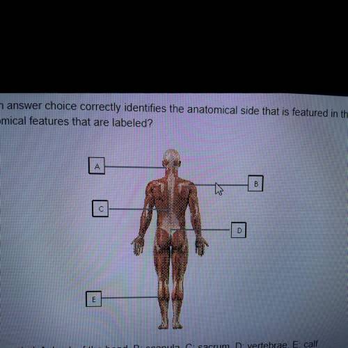 Which answer choice correctly identifies the anatomical side that is featured in the diagram below