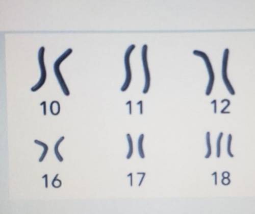 Can the gender of the patient (male or female) be identified from the section of the karyotype show
