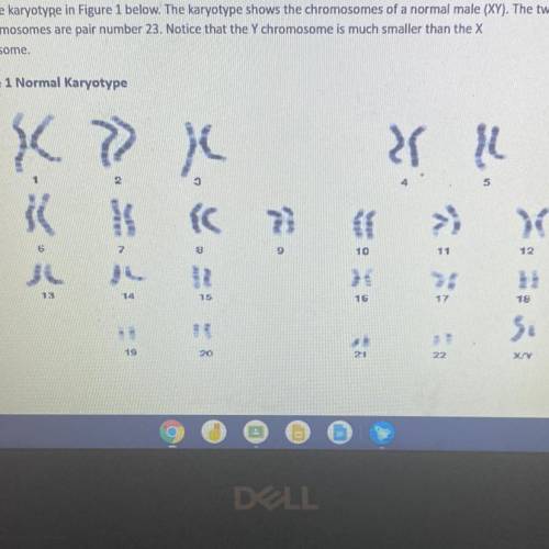 How many autosomes in figure 1 ?

How many sex chromosomes are in figure1 ?
What is the name of th