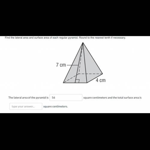 Please help me find the total surface area.
