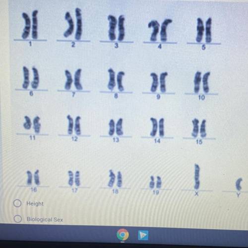 Below is a karyotype; an image of a person's chromosomes. Pairs 1 - 22 are

called autosomal and c