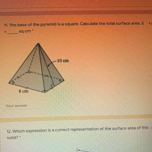 Yooo pls help fr.. whats the total surface area :( ive srsly been doing this for five hrs