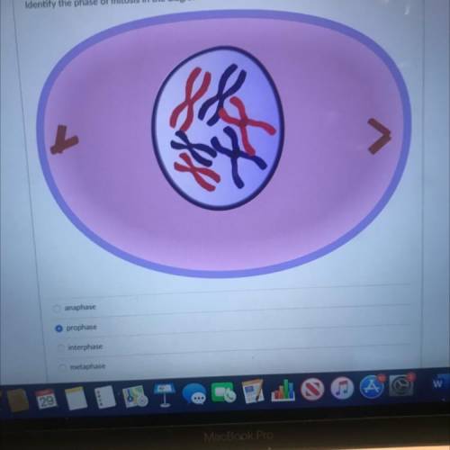 Is this prophase or interphase i dont know