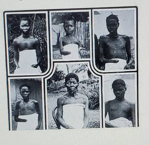 The picture shows Congolese people who were mutilated during Belgium rule. In the 1900s, Congolese