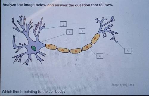Which line is pointing to the body cell?

A. 1B. 2C. 4D. 5Please select the best answer provided​