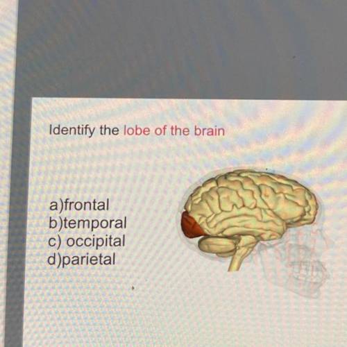 Identify the lobe of the brain
a)frontal
b)temporal
c) occipital
d)parietal
