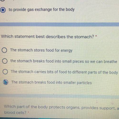 Which statement best describes the stomach?