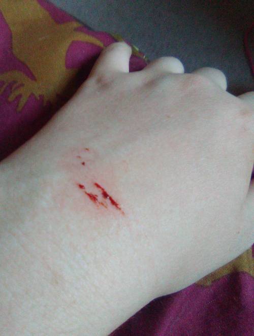 hey I need help I cut myself because I was sad and then when I cut myself I was happy what wrong wi