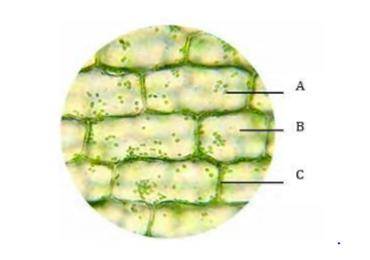The cells in this image of the microscope's fiel of view are most likely from a ____.

A. Bacteriu