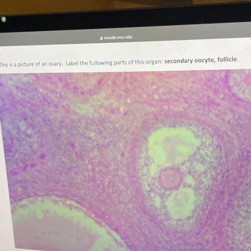 3) This is a picture of an ovary. Label the following parts of this organ: secondary oocyte, follic