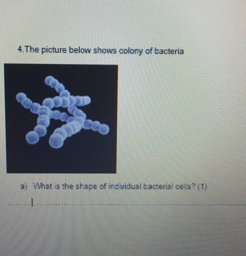 4. The picture below shows colony of bacteria

a) What is the shape of individual bacterial os s?