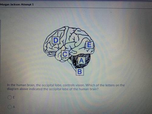 In the human brain, the occipital lobe, controls vision. Which of the letters on the diagram above