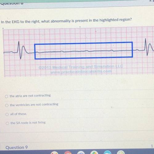 In the EKG to the right, what abnormality is present in the highlighted region?