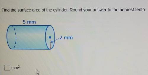 Find the surface area of the cylinder. Round your answer to the nearest tenth. ​