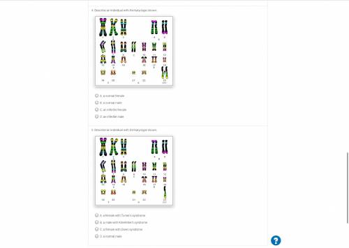4. Describe an individual with the karyotype shown.

5. Describe an individual with the karyotype