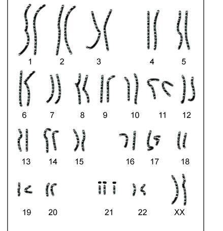 What can be concluded by viewing this karyotype?

A 
It is from a female with a normal set of chro
