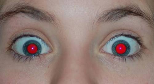 Post a picture of your own eyes if you have red eyes.