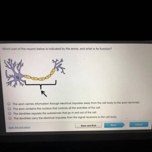 Which part of the neuron below is indicated by the arrow, and what is its function?

A)The axon ca