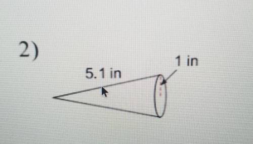 ♡LOTS OF POINTS TO RIGHT ANSWER♡

------Find the surface area of the figure, round your answer to