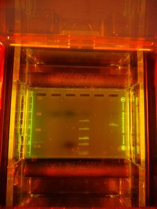 I need help with this gel electrophoresis biology lab please